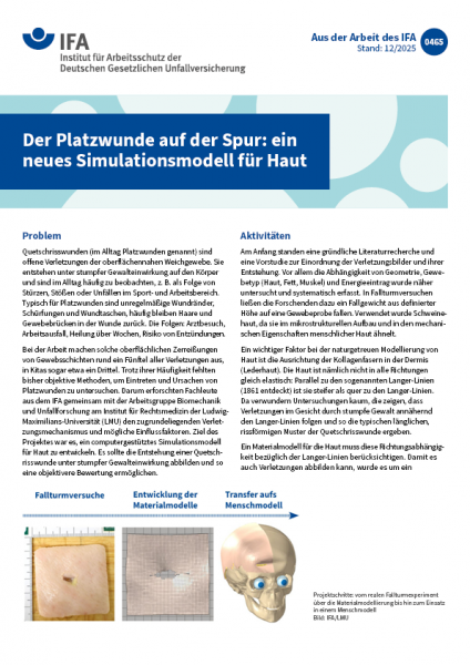 Der Platzwunde auf der Spur: ein neues Simulationsmodell für Haut (Aus der Arbeit des IFA Nr. 0465)